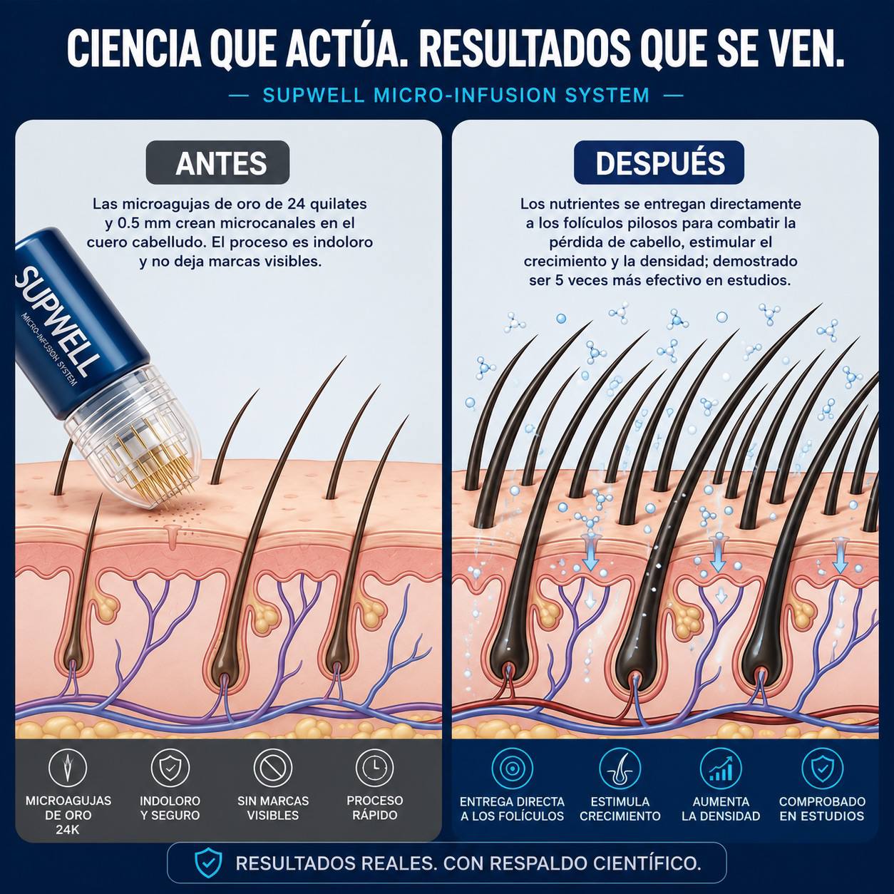 Sistema de Microinfusión Capilar