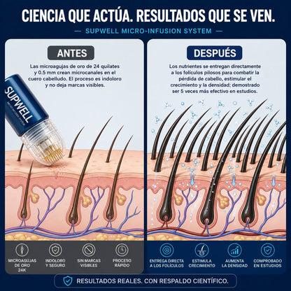 Sistema de Microinfusión Capilar