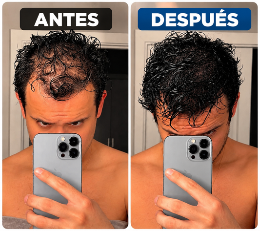 Recupera densidad capilar y fortalece tu cabello desde la raiz